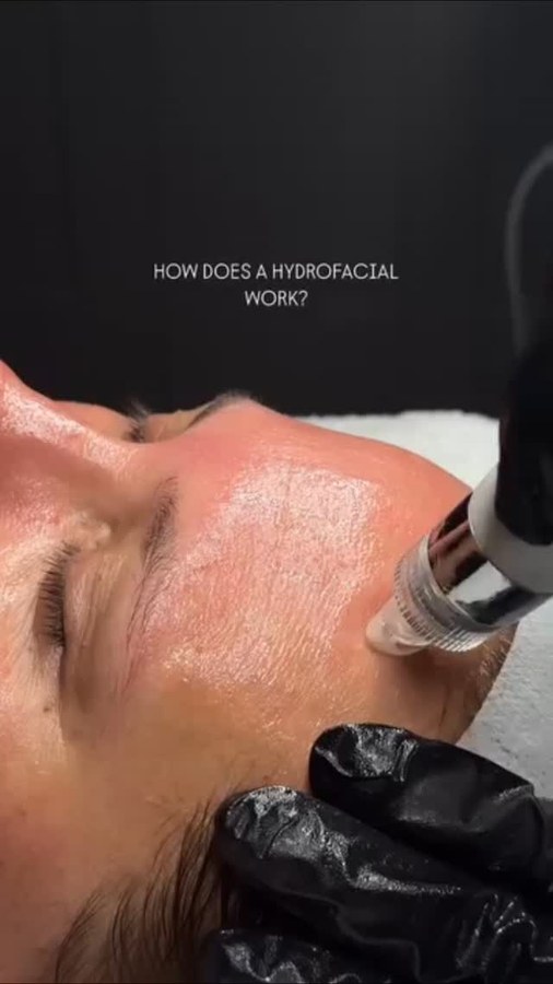 How does a HydraFacial work — treatment close-up at Namah Clinic