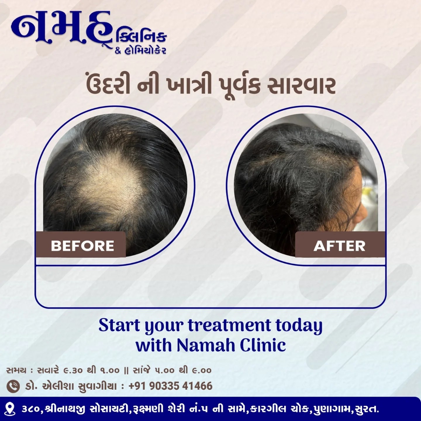 Alopecia treatment on a female patient: before and after photos